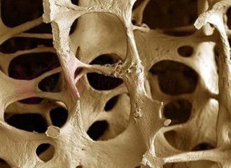 Obrazek: Bezpłatne badania w kierunku osteoporozy
